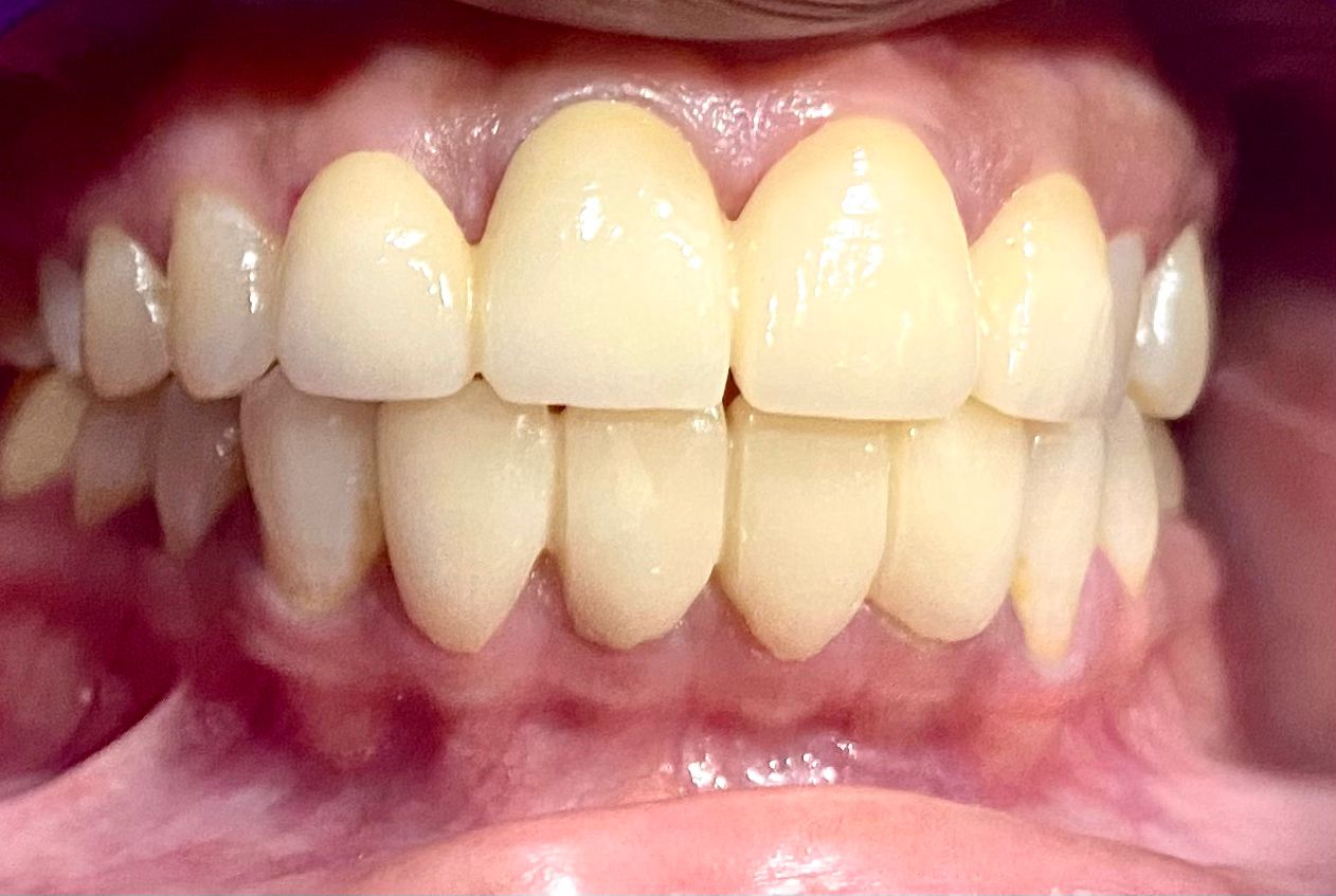 After Image